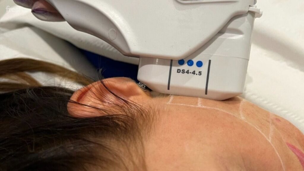 Fat Freezing Treatment Clinic- fat reduction - Vivo Body Studio, Manchester, UK