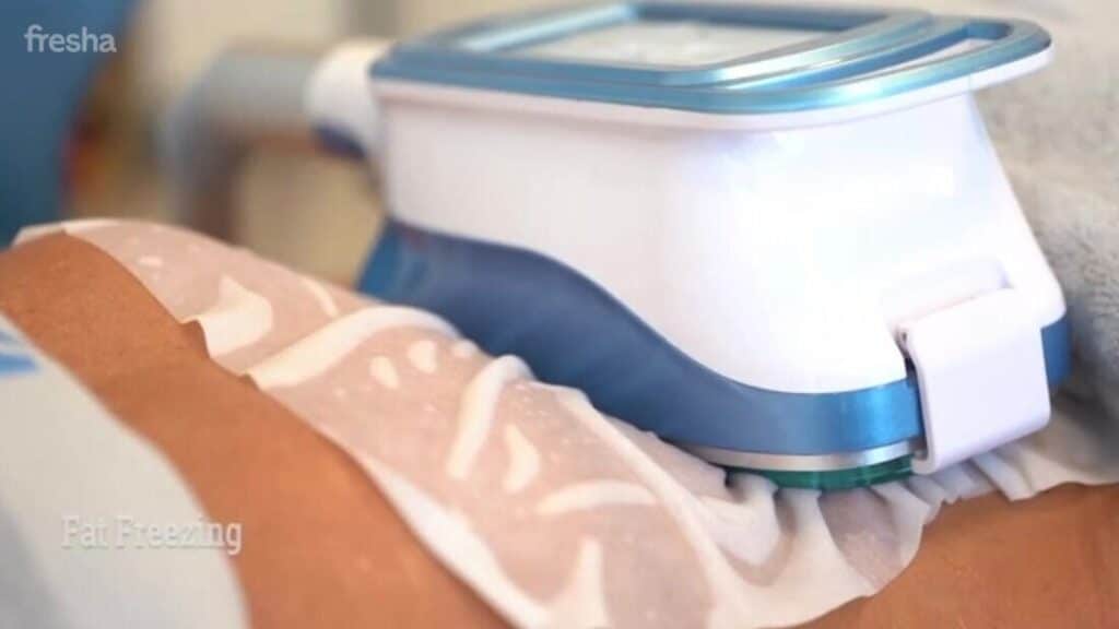 Fat Freezing treatment Clinic- Vivo Body Studio, Leeds, UK